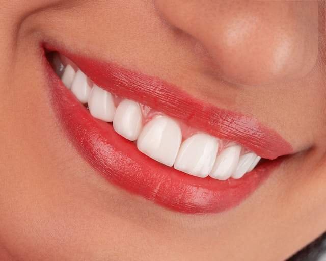Teeth Whitening Home Remedies: 10 Natural Ways to Get a Brighter Smile